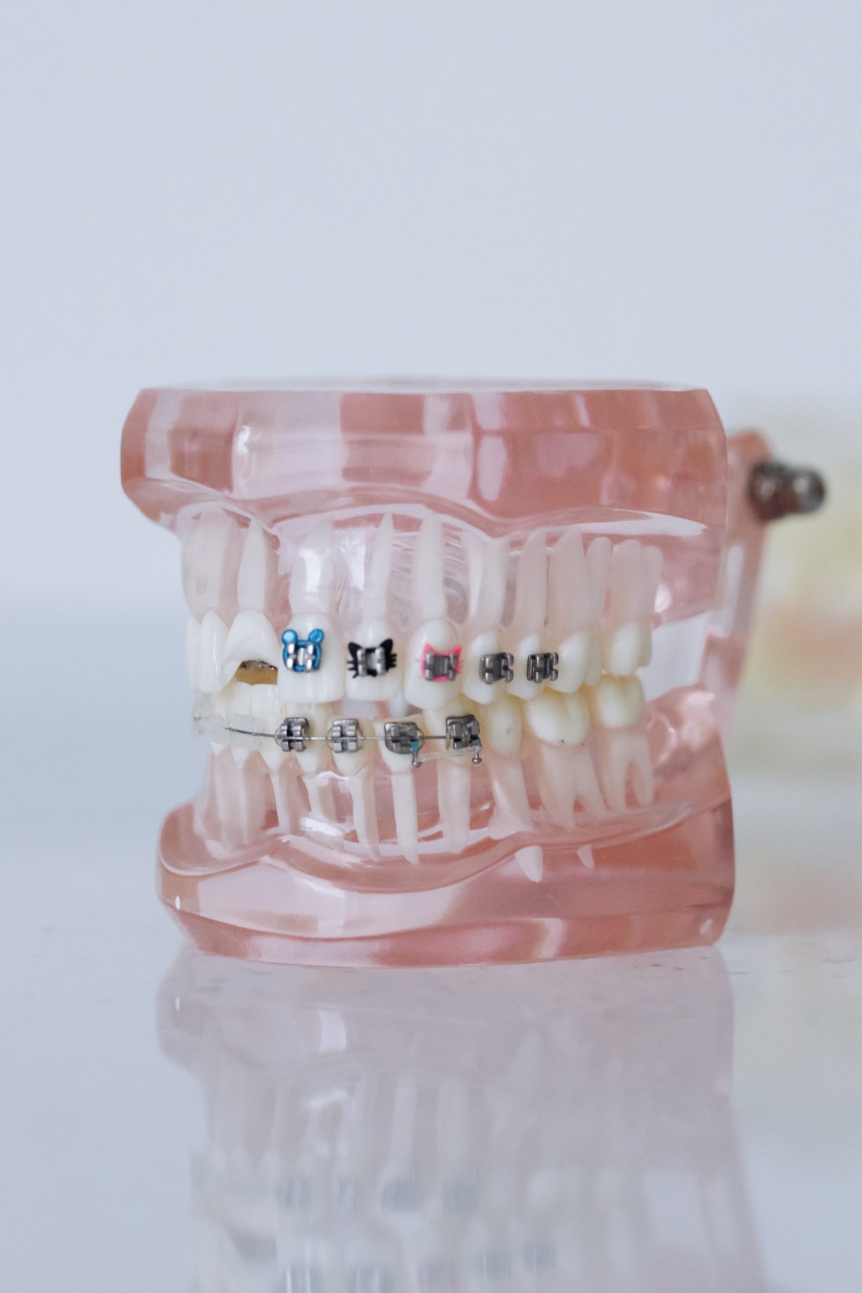 dental model with braces